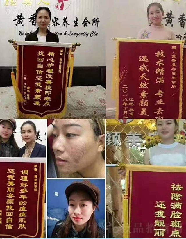 ���\���(y��ng)��Ĥ�׺�